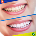 5D Whitening Teeth Patch - thedealzninja