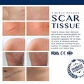 Advance Siliconce Scar Remover Gel