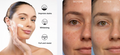Effective Whitening Freckle Cream Remove Dark Spots