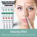 Herbal Anti Acne Cream