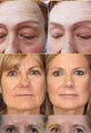 Anti Aging Remove Wrinkle Serum