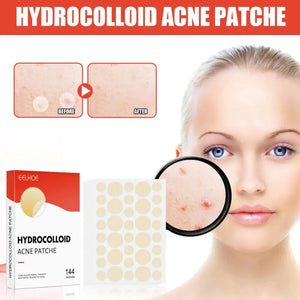 Hydrocolloid Acne Pimple Patch