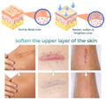 Bioskin™ Advanced Scar Removal Gel