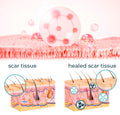 Bioskin™ Advanced Scar Removal Gel